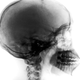 Illustration for article titled Save On Hospital Bills, X-Ray Yourself With Sticky-Tape